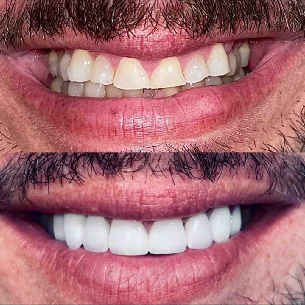Smile Gallery - Byrne Dental